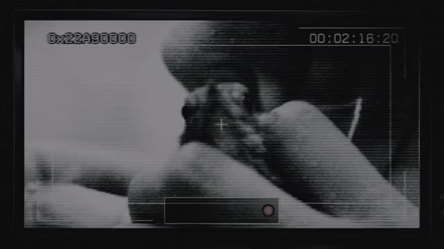 E1.Surveillance